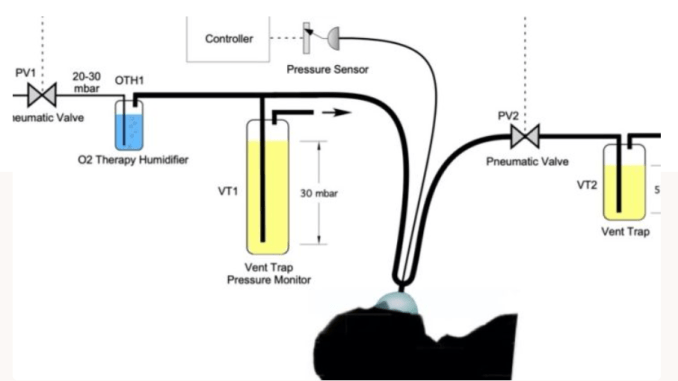 Particle Physicists Develop New Vent for COVID-19 Use